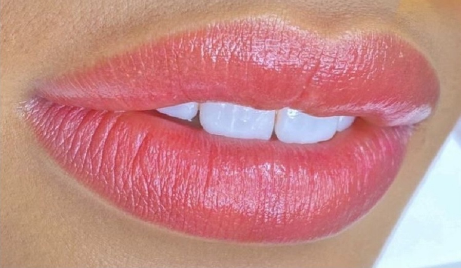 lèvres après
