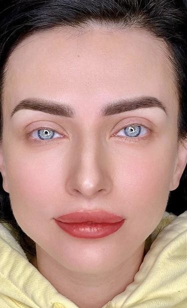 visage après